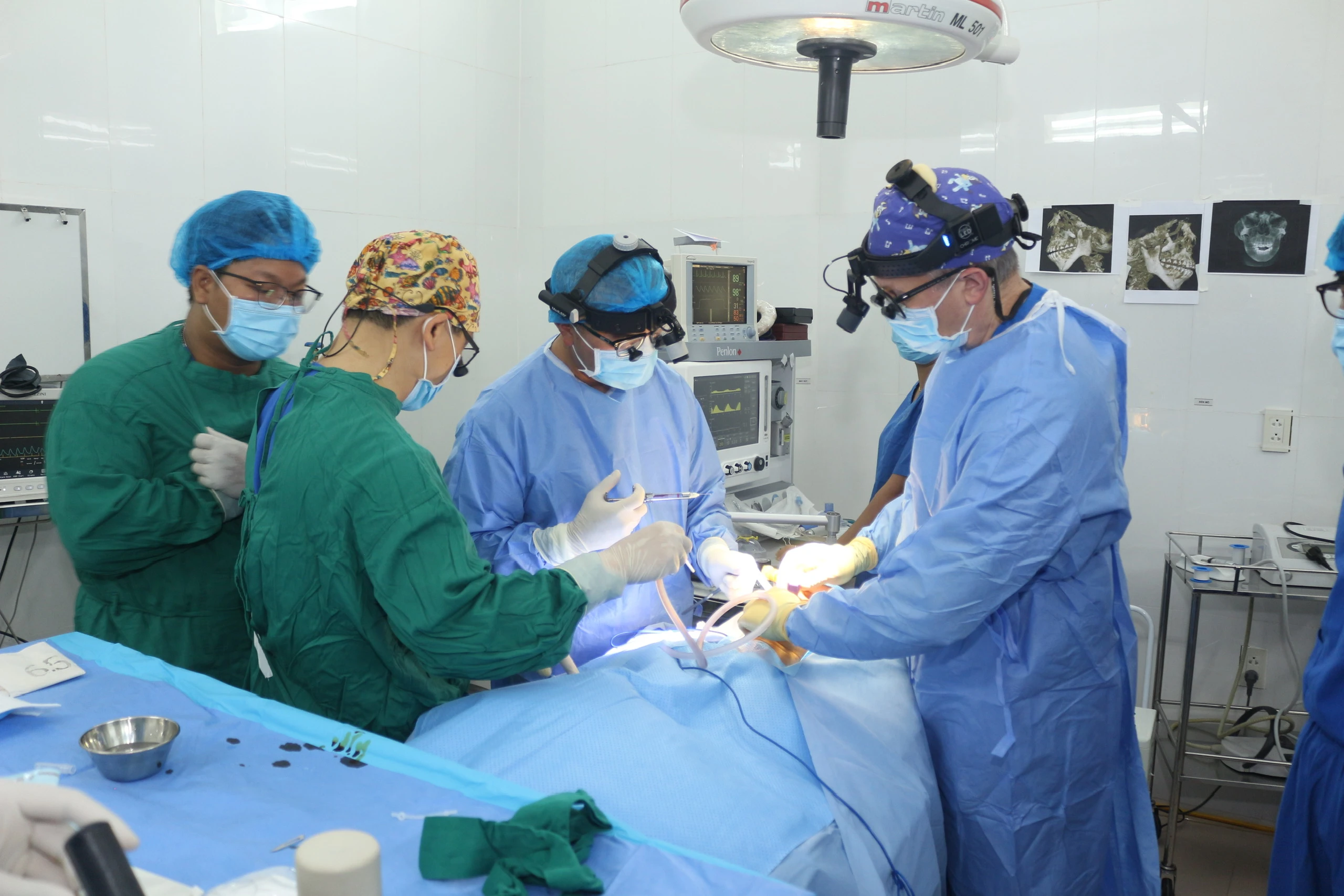 Bệnh viện Răng Hàm Mặt Huế: Phẫu thuật tạo hình miễn phí, thay đổi cuộc đời cho bệnh nhân dị tật